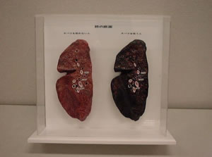 肺モデル①