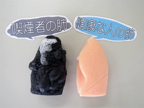 肺モデル②