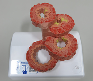 COPDの気管支モデル