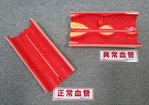 病変血管サンプル