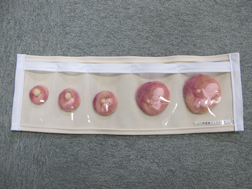 胎芽～胎児モデル