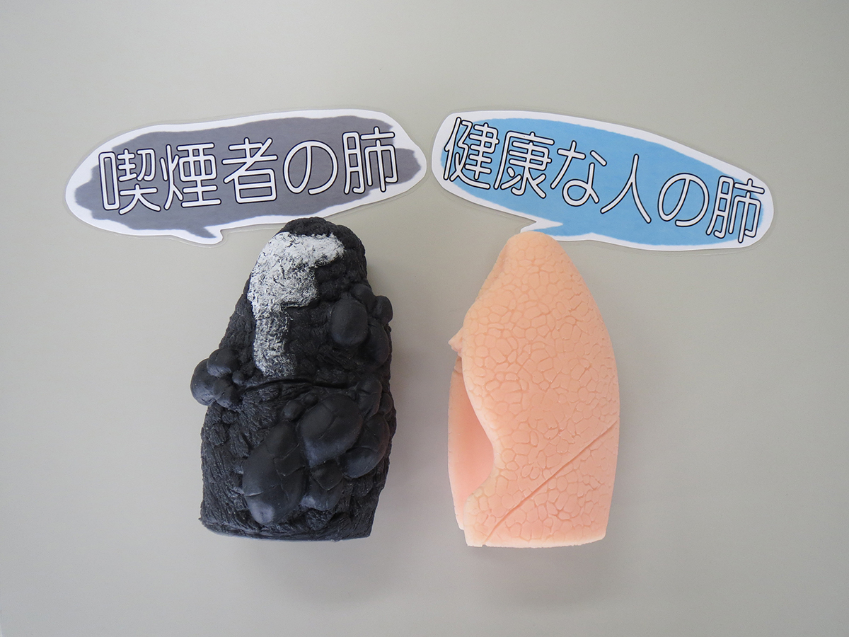 肺モデル②