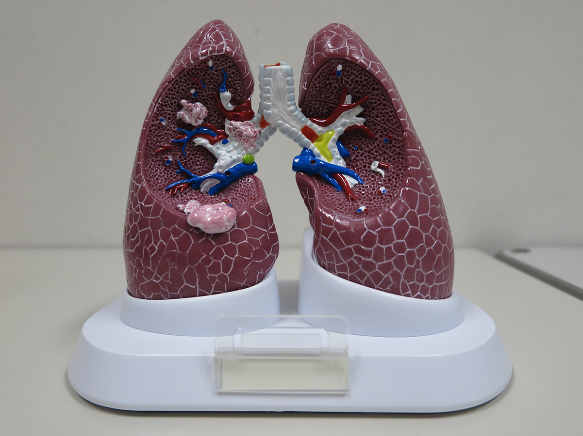 肺疾患モデル