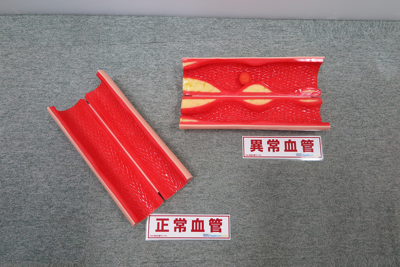 病変血管サンプル